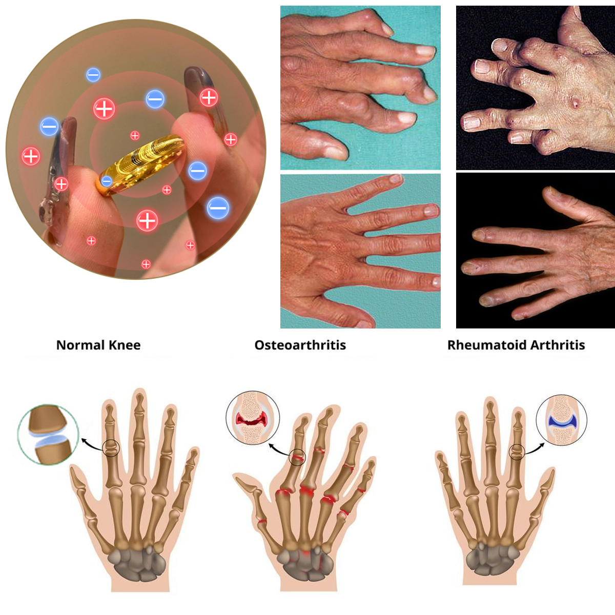 Christmas Limited Time Offer🎄 - Up to 90% OFF! 🎅DIYSTAR Lymphatic Magnetic Therapy Cat's Eye Ring