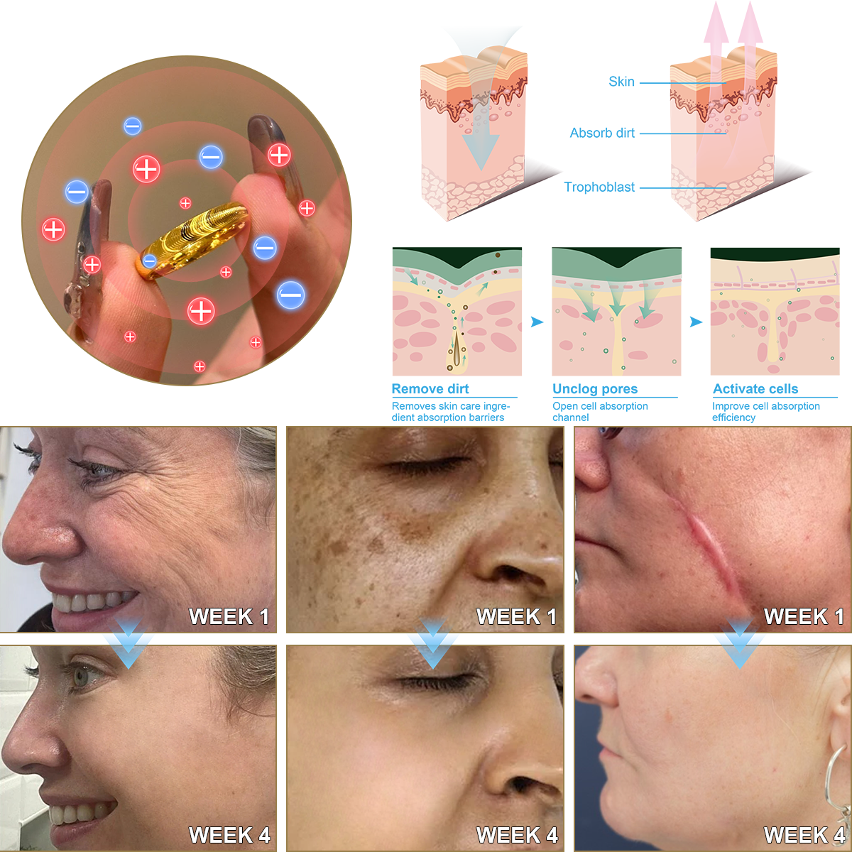 Christmas Limited Time Offer🎄 - Up to 90% OFF! 🎅DIYSTAR Lymphatic Magnetic Therapy Cat's Eye Ring