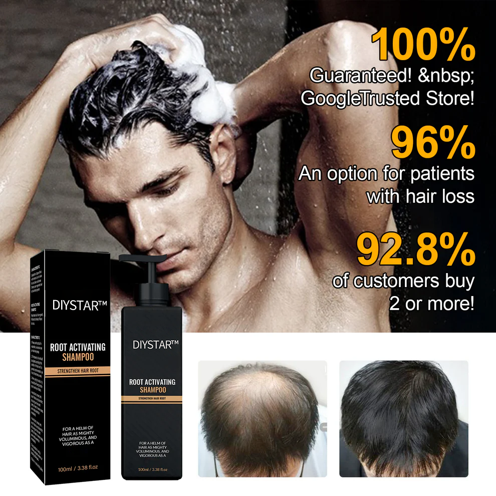 DIYSTAR™Root Activator Shampoo- Regain a full head of hair in just 6 weeks!