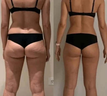  Mieclass- EMS buttocks trainer