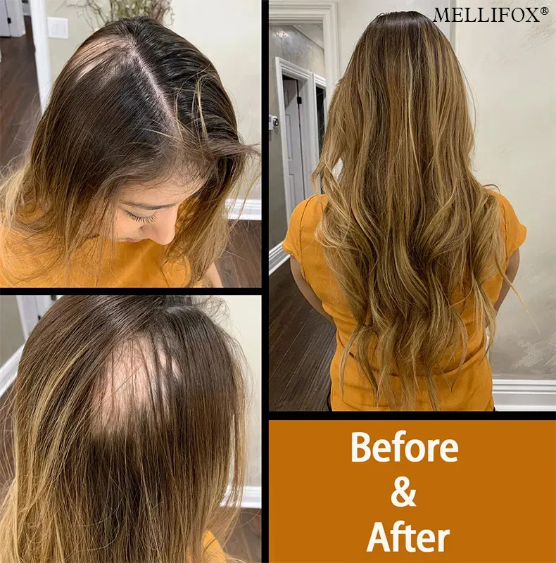 🔥$9.99 Today Only 🎁Mellifox®Virgin Human Hair Seamless Tape-In Extensions