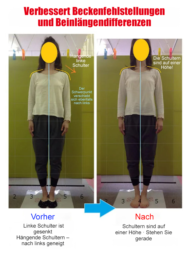 5cm Plateau-Wedgesandalen im koreanischen Stil mit offenem Zeh – echtes Leder ohne Fußschmerzen bei langem Gehen