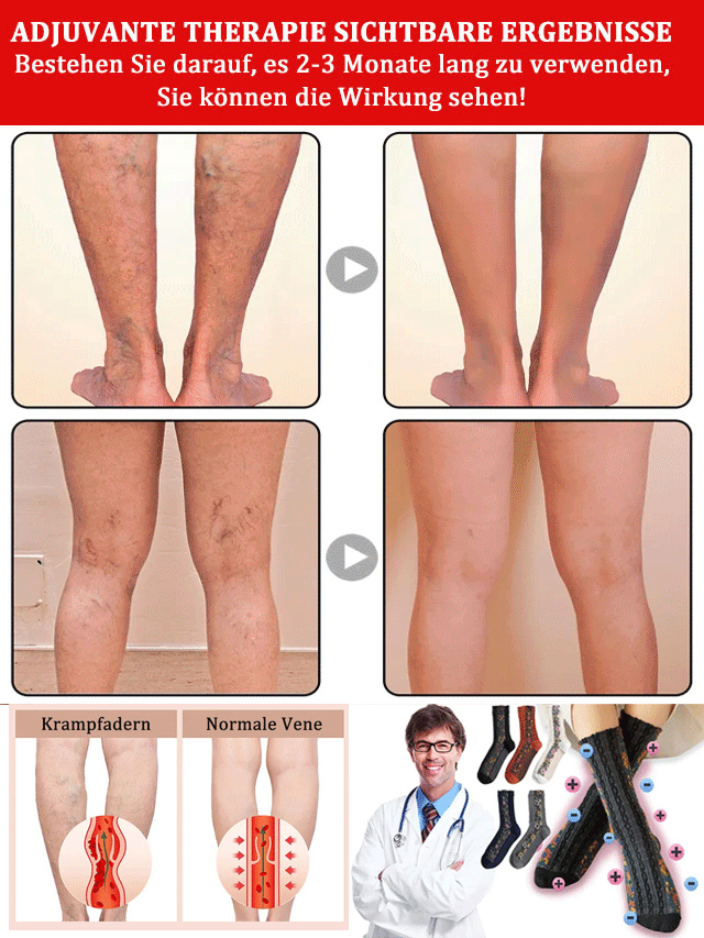 Kompressionsstrümpfe (20–30 mmHg) mit Baumwolle für Damen und Herren