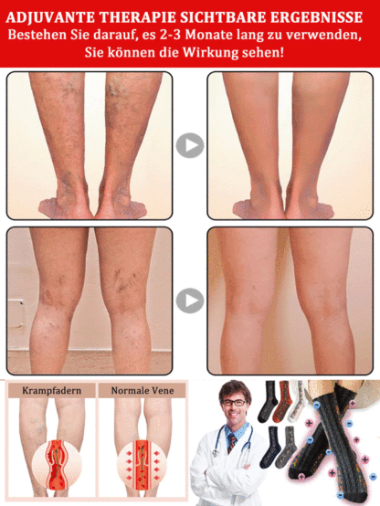 Kompressionsstrümpfe (20–30 mmHg) mit Baumwolle für Damen und Herren