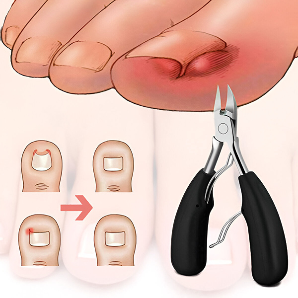 Kit profesional pentru îngrijirea unghiilor NAILPRO