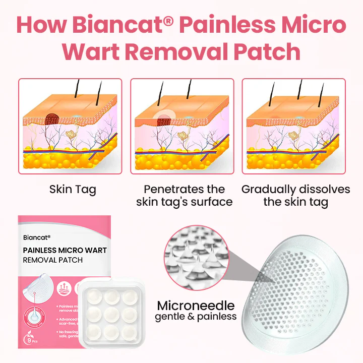 Plasture nedureros Biancat® pentru îndepărtarea negilor micro