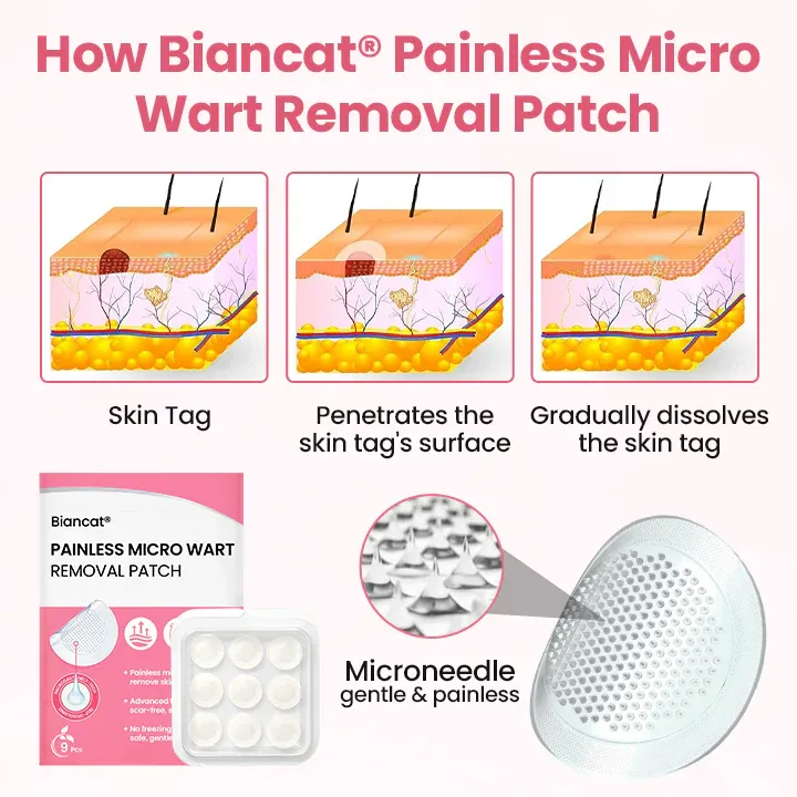 Plasture nedureros Biancat® pentru îndepărtarea negilor micro
