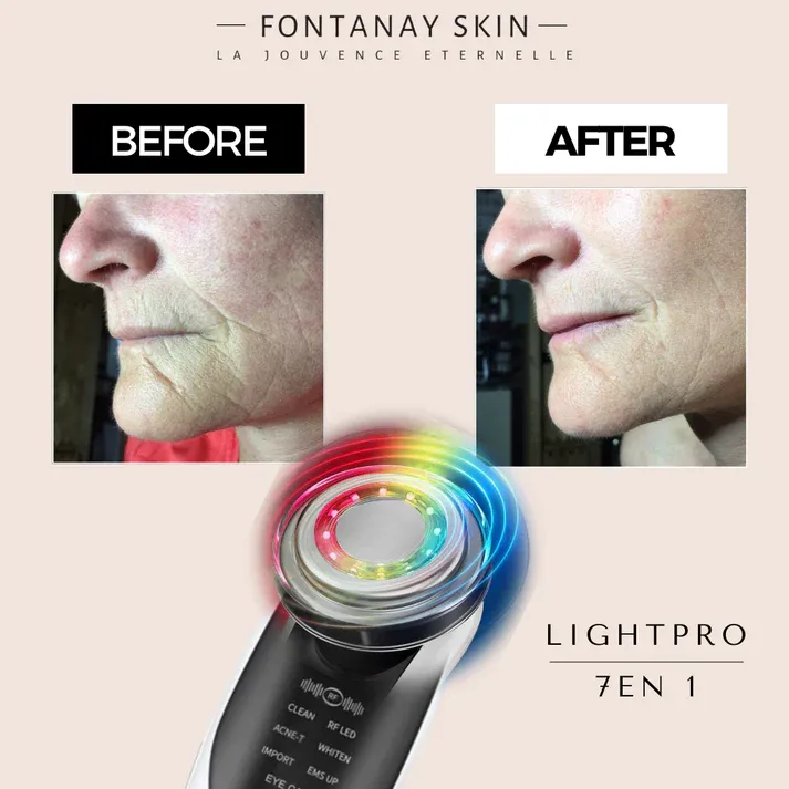 Terapia cu lumină de ridicare LightPro 7in1 Fontanay™