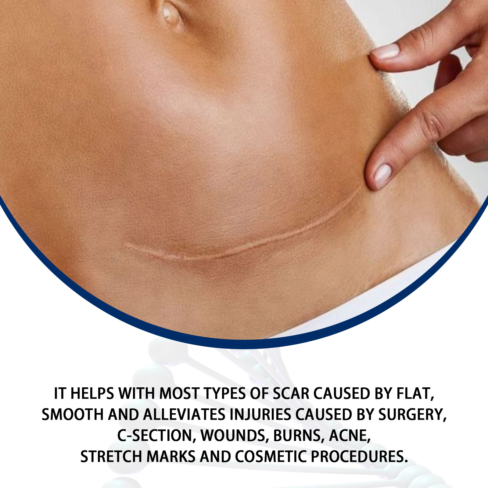 Jaysuing Skinuva Scar Repair Gel 30g Smooth Skin for All Skin Types