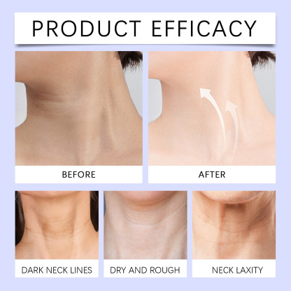 OUHOE tighten and lift neck cream