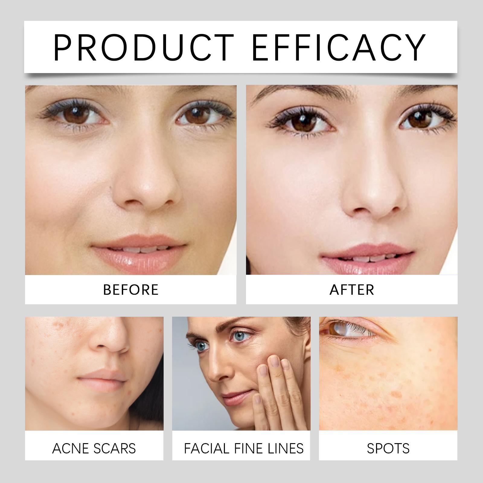 Hoygi freckle whitening cream