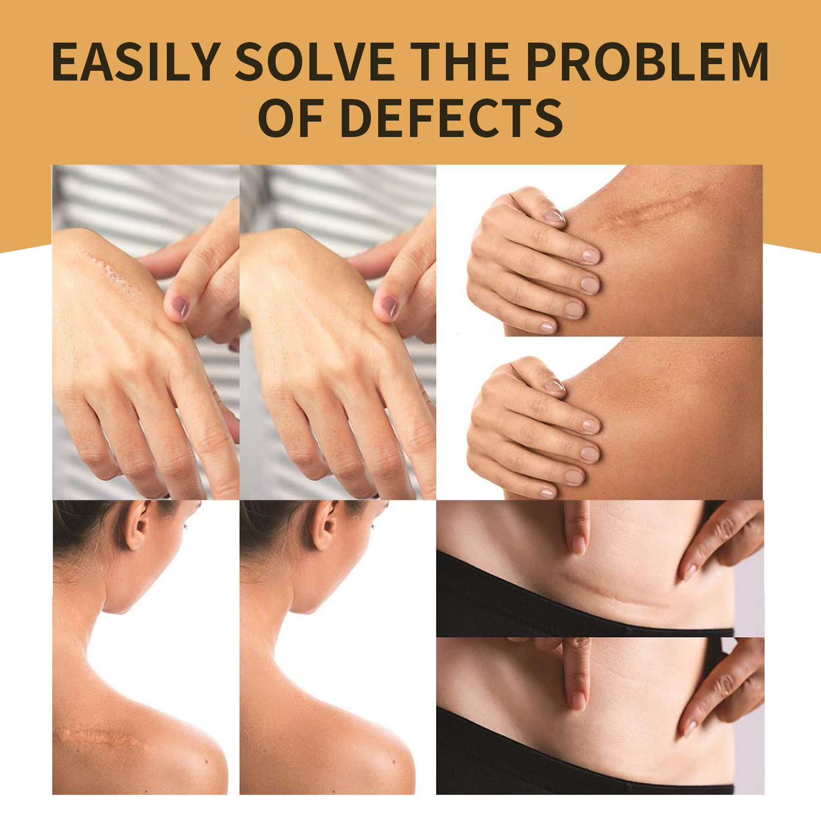 Jaysuing invisible concealer patch skin concealer tattoo scar cover patch invisible waterproof skin color cover patch-CLEJOY