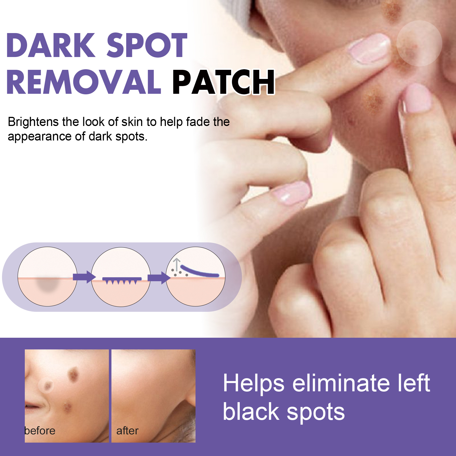 EELHOE spot patch lightens facial dark spots, chloasma, pigmentation, melanin, moisturizes and whitens skin spots-CLEJOY