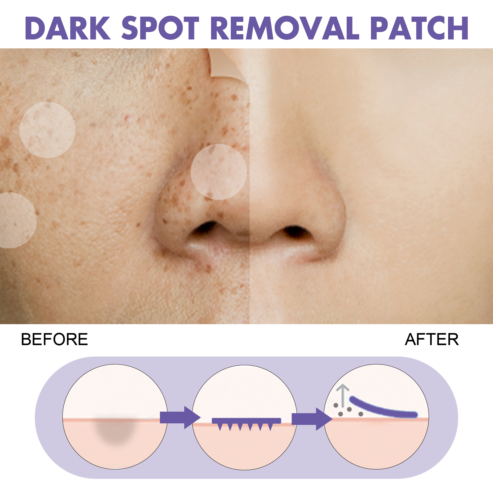 EELHOE spot patch lightens facial dark spots, chloasma, pigmentation, melanin, moisturizes and whitens skin spots-CLEJOY