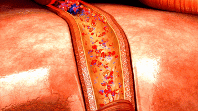 Docteat Chili Softgels