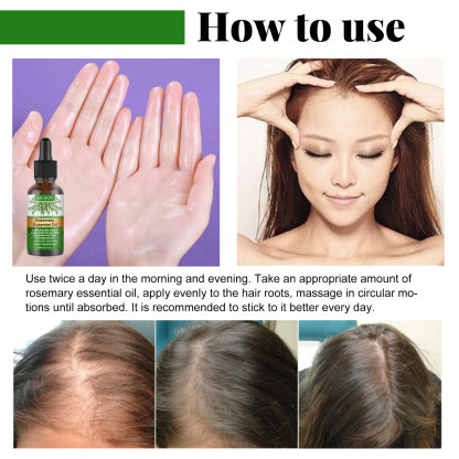EELHOE Rosemary Hair Oil Gentle care scalp soft and shiny natural fluffy hair oil
