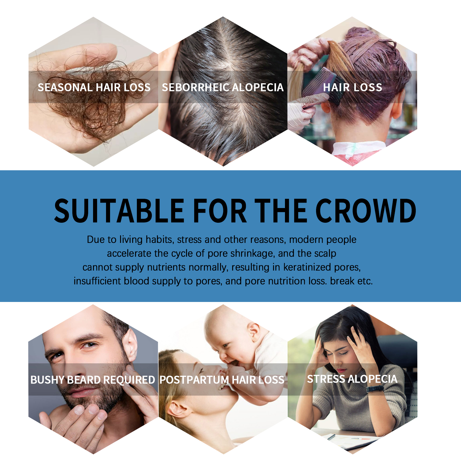 East Moon Roll-on Hair Oil Moisturizing Scalp Massage Care Gentle Nourishing Hair and Beard Care Oil