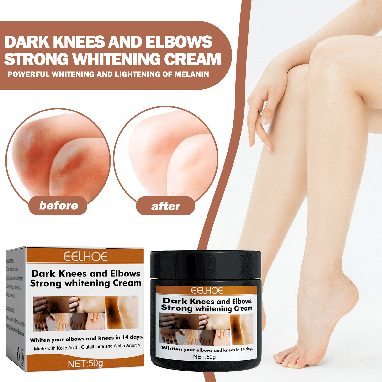 EELHOE Joint Whitening Cream Nourishes and brightens dull skin Joint and elbow repair cream