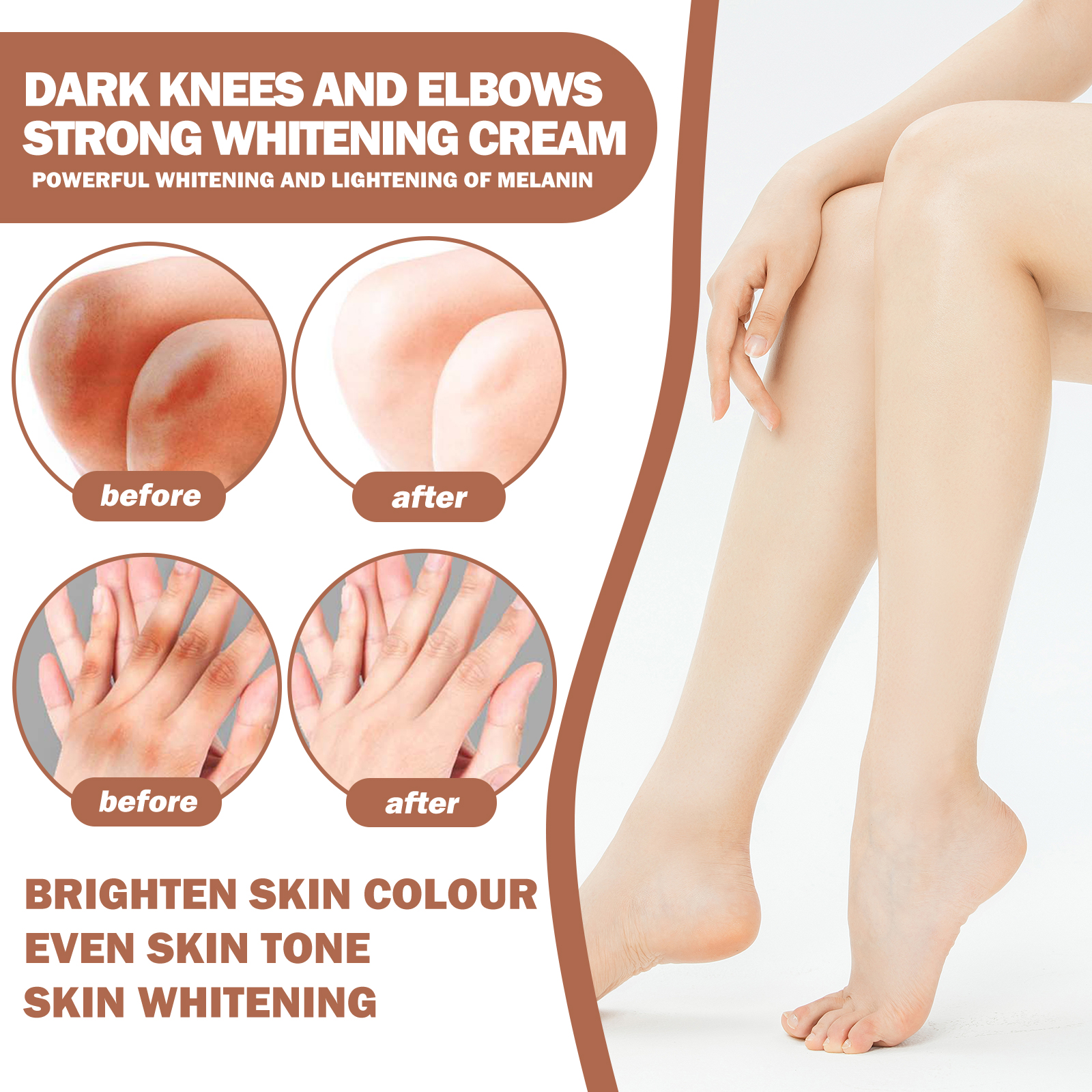 EELHOE Joint Whitening Cream Nourishes and brightens dull skin Joint and elbow repair cream