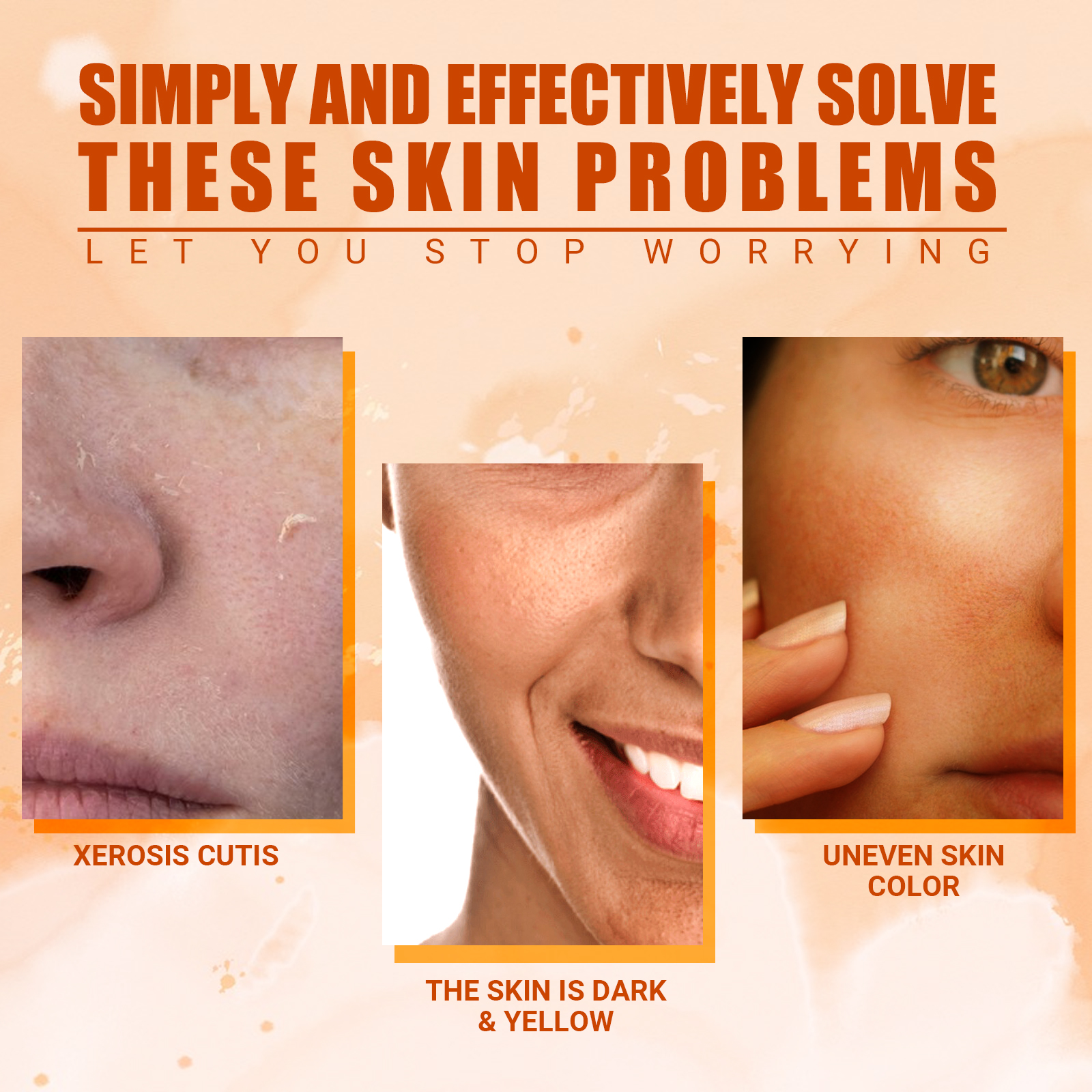 EELHOE Vitamin C Moisturizing Spray Hydrates and Nourishes the Skin, Lightens Acne and Spots, Rejuvenates and Whitens-CLEJOY