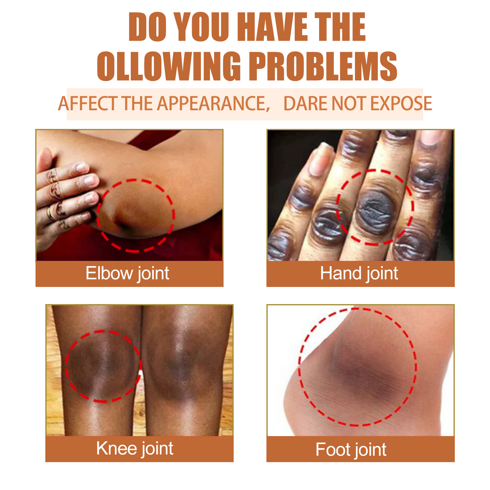 EELHOE papaya seed skin care oil lightens dark spots, bend joints and elbows, brightens skin tone and moisturizes skin care oil-CLEJOY