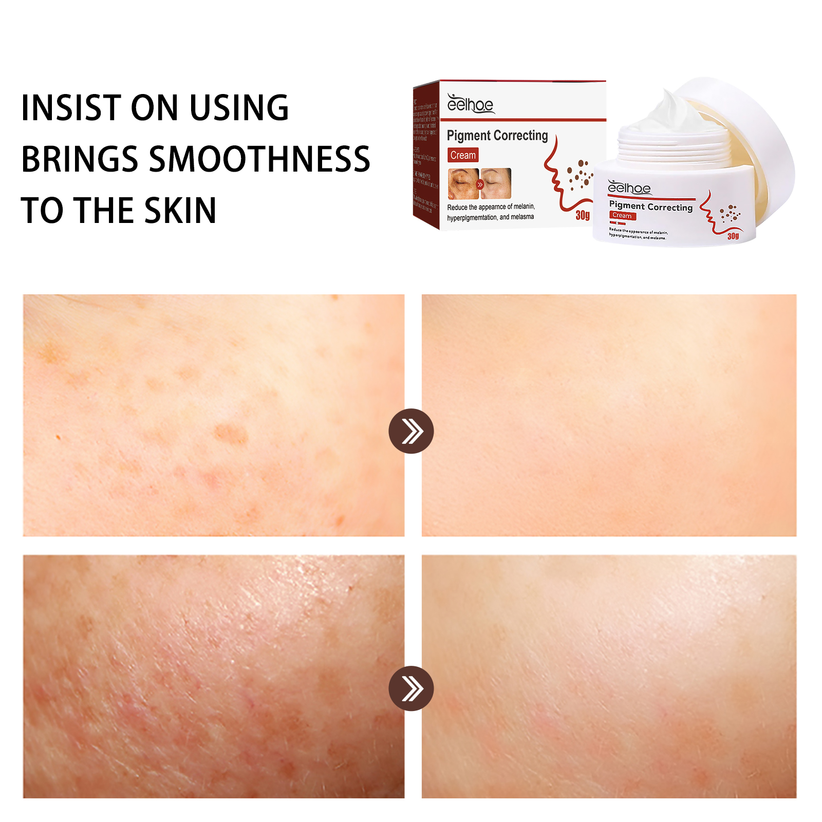 EELHOE pigment repair cream moisturizing and fading freckles, dark spots, chloasma and melanin beauty cream-CLEJOY