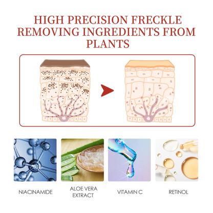 EELHOE pigment repair cream moisturizing and fading freckles, dark spots, chloasma and melanin beauty cream-CLEJOY