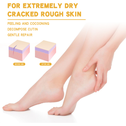 EELHOE Soothing and chapped foot cream foot care heel moisturizing anti-drying and peeling chapped repair foot cream-CLEJOY