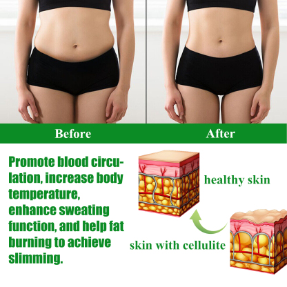 EELHOE mugwort leg lifting patch firming leg fat anti-cellulite lazy body shaping to create beautiful legs slender-CLEJOY