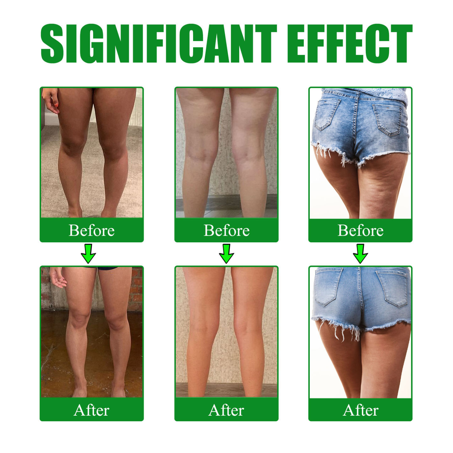 EELHOE mugwort leg lifting patch firming leg fat anti-cellulite lazy body shaping to create beautiful legs slender-CLEJOY