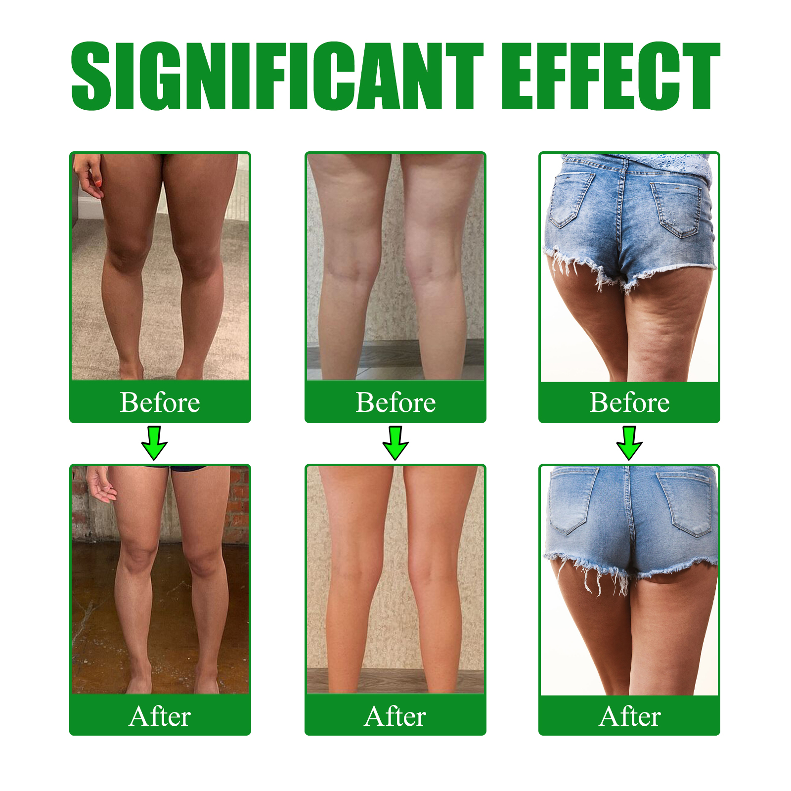 EELHOE mugwort leg lifting patch firming leg fat anti-cellulite lazy body shaping to create beautiful legs slender-CLEJOY