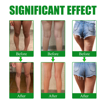 EELHOE mugwort leg lifting patch firming leg fat anti-cellulite lazy body shaping to create beautiful legs slender-CLEJOY