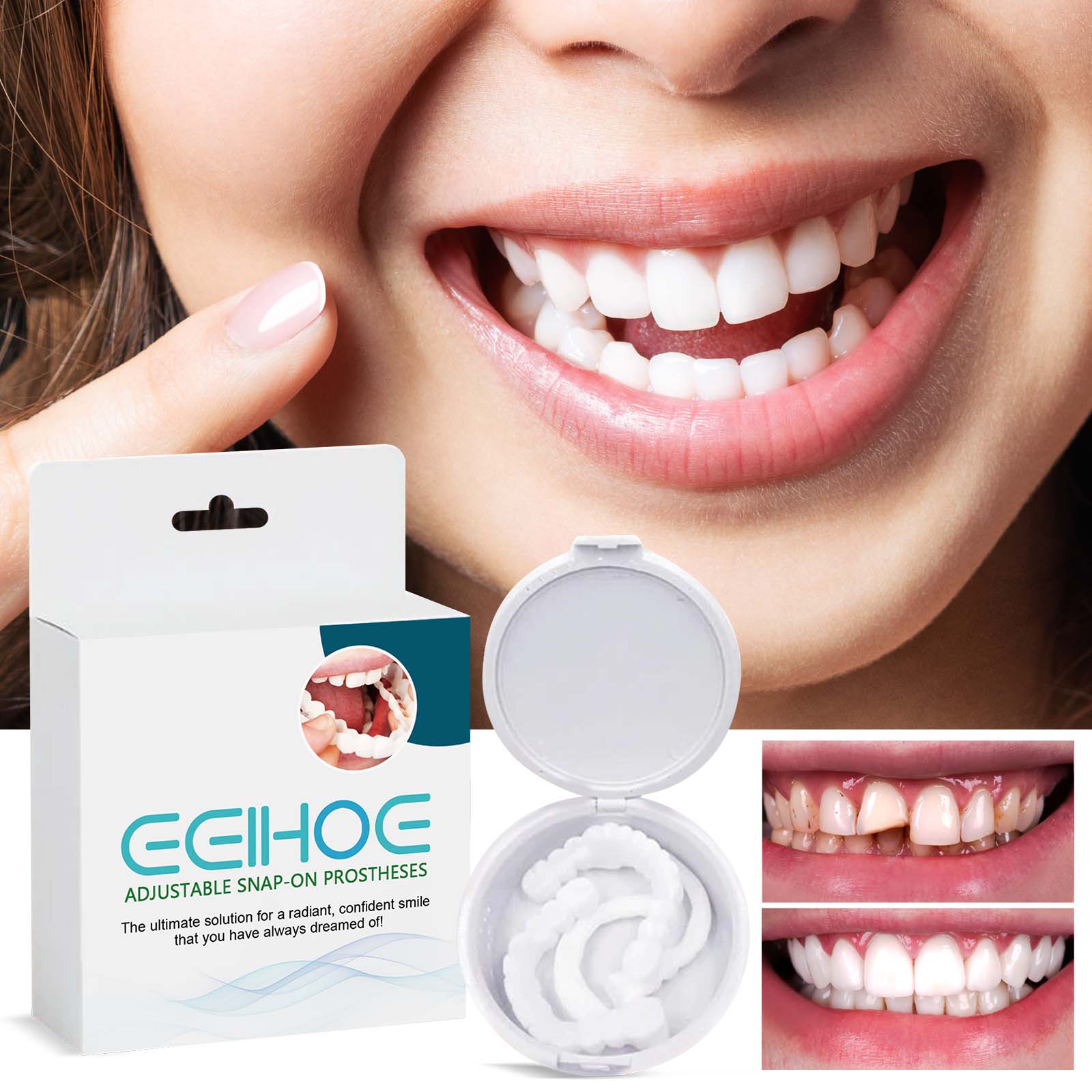EELHOE Snap-on Dentures Kit: Professional teeth repair and fix for a radiant smile finish.
