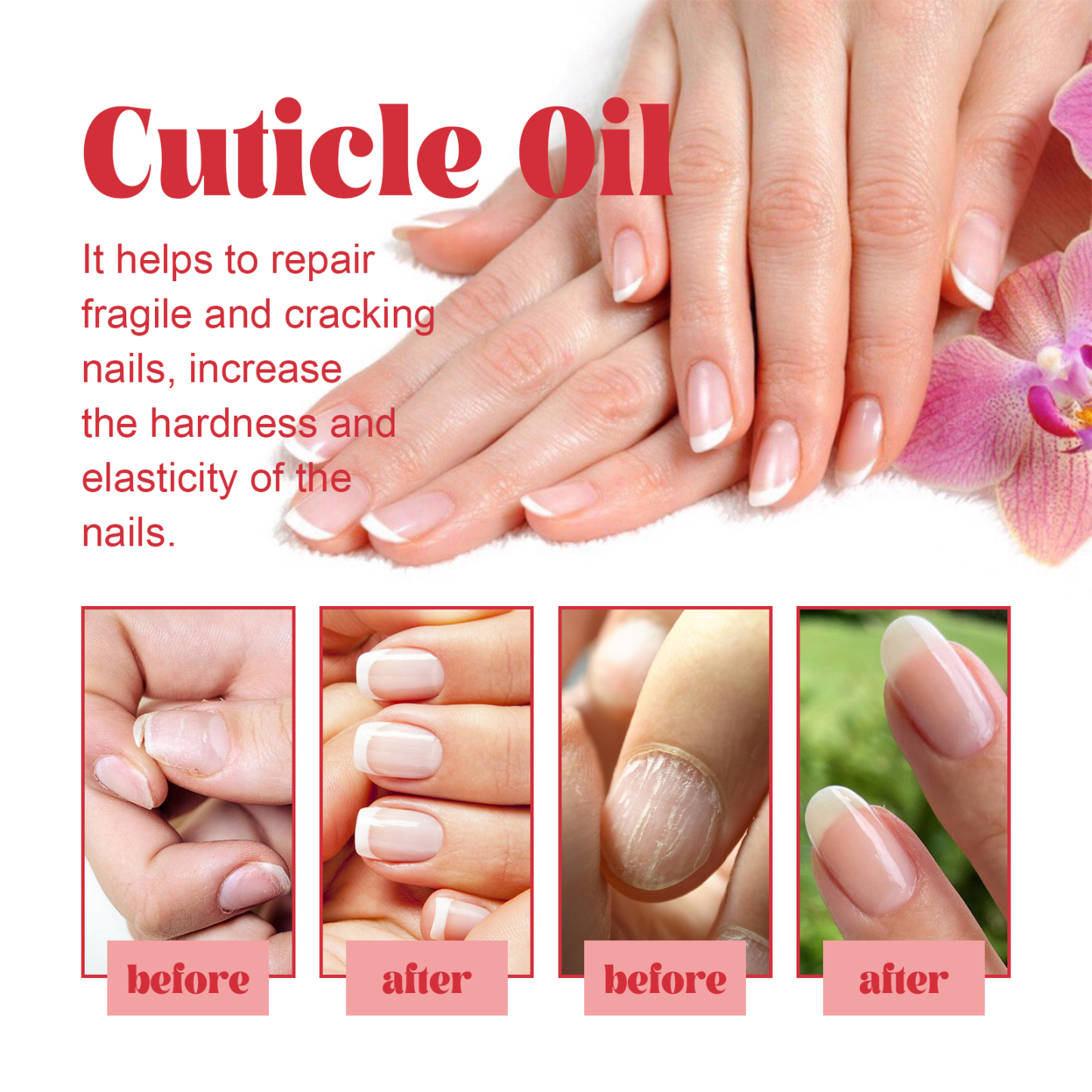 EELHOE peach nail care oil repairs hand and foot nail rotten nail onychomycosis brightening nail thickening care liquid-CLEJOY