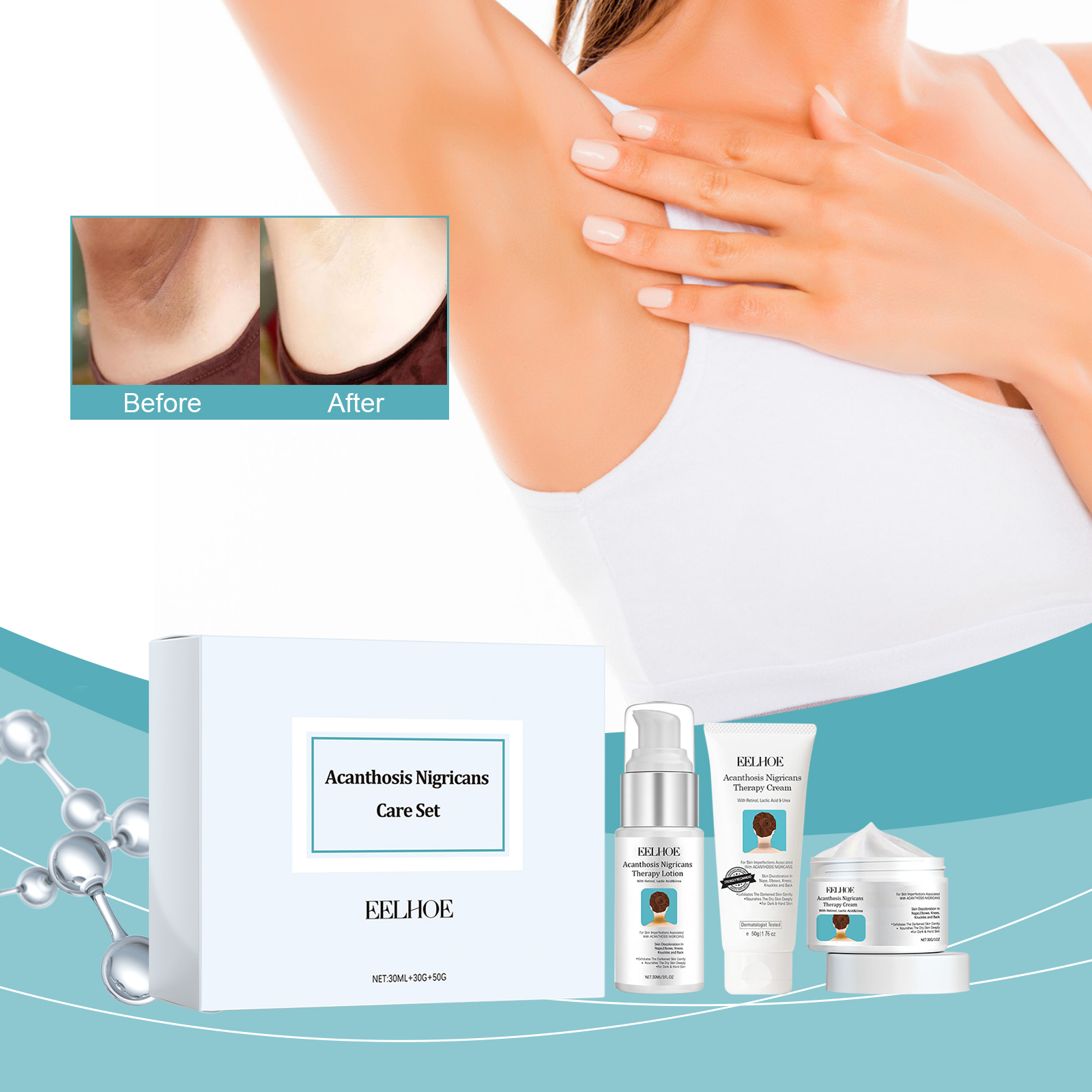 EELHOE Black Acanthosis Repair Set Repairs Underarms, Arms, Knees, Joints, Black Moisturizing and Whitening Body Care Cream-CLEJOY