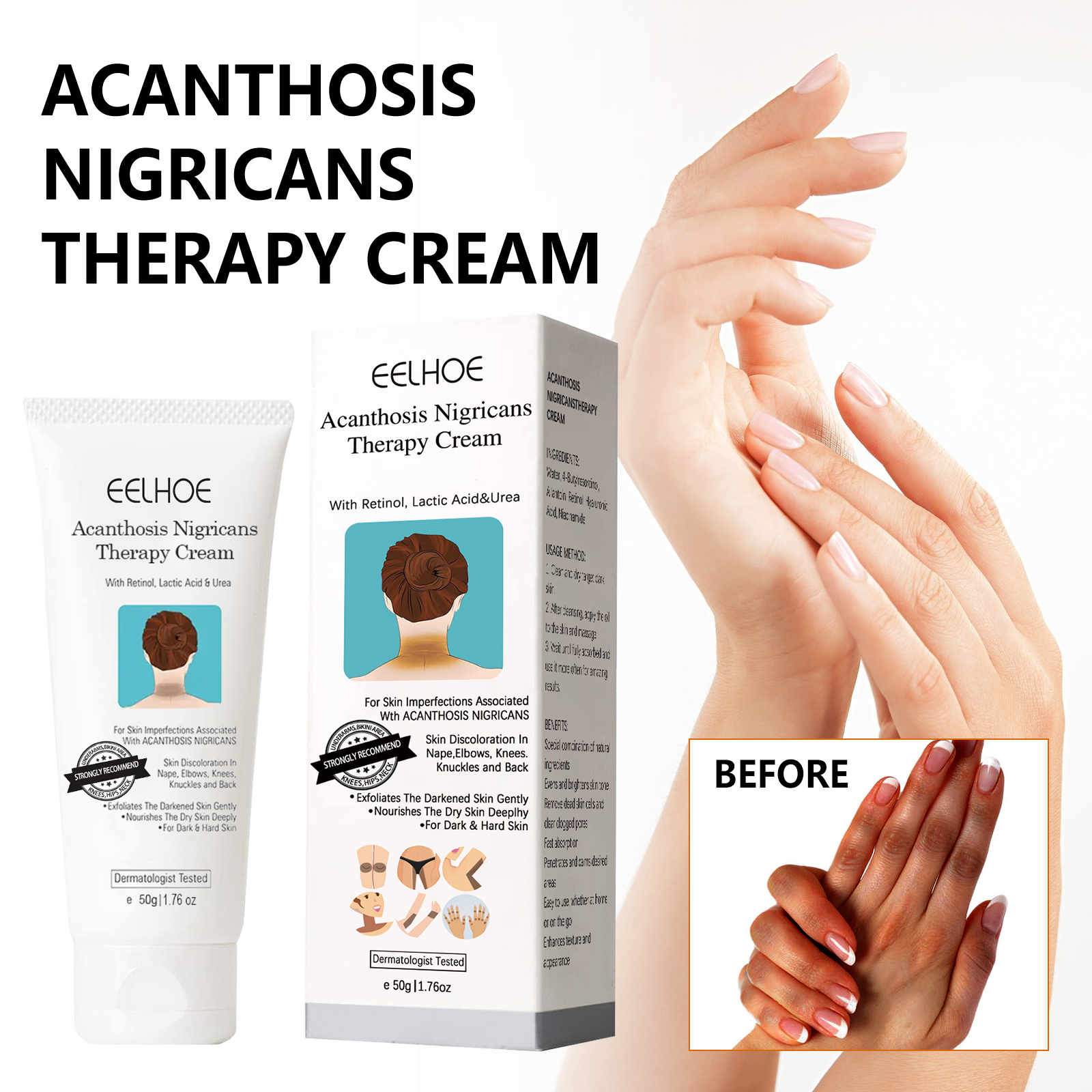EELHOE Black Acanthosis Repair Cream Repairs underarms, arms, knees, joints, black moisturizing and whitening body care cream-CLEJOY