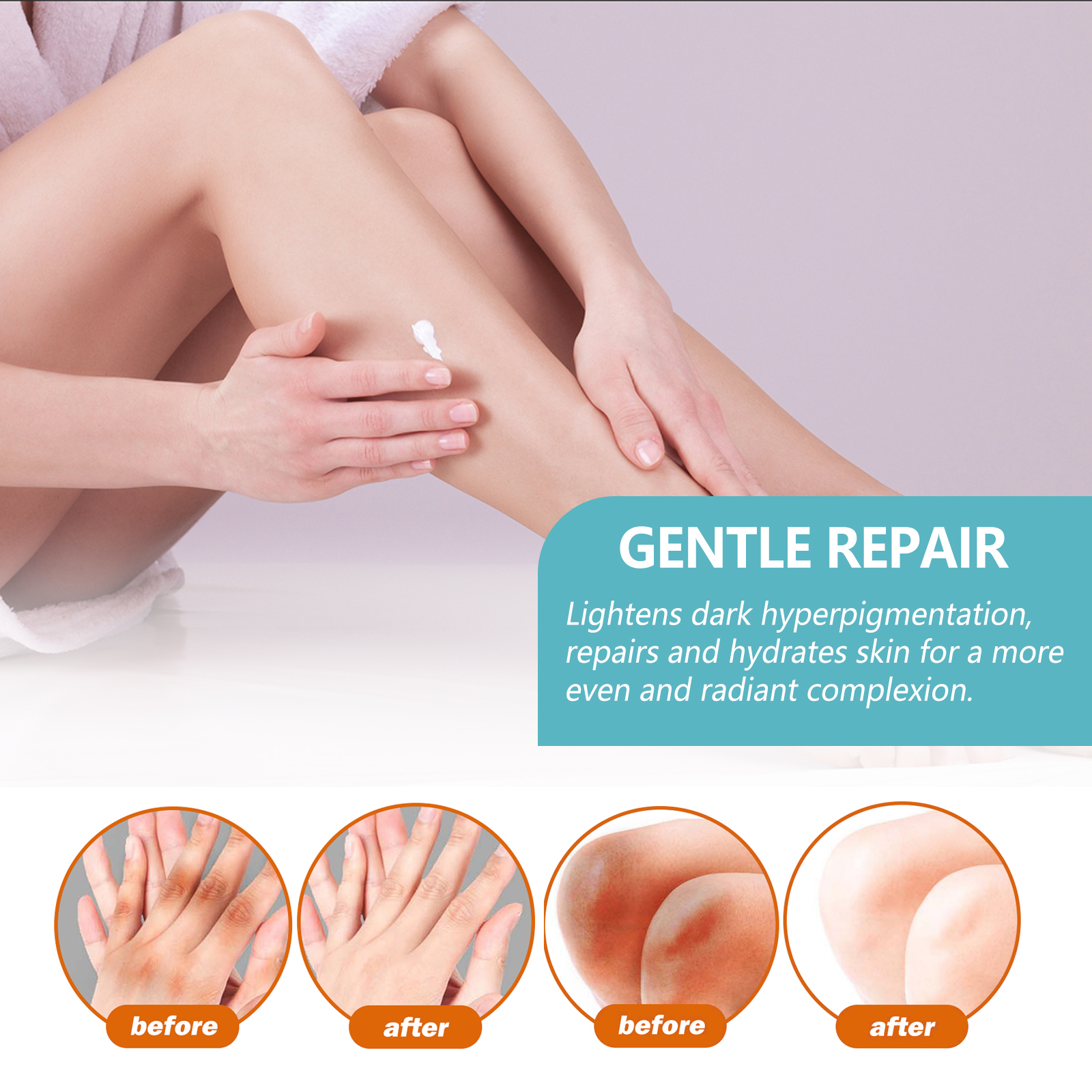 EELHOE Black Acanthosis Repair Cream Repairs underarms, arms, knees, joints, black moisturizing and whitening body care cream-CLEJOY