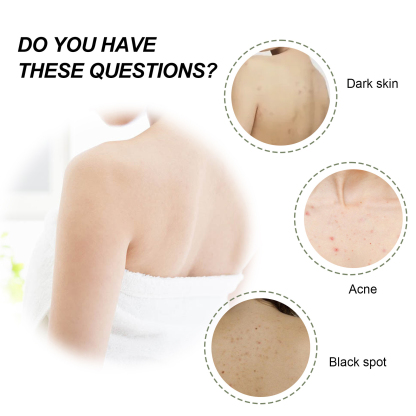 EELHOE Turmeric Body Scrub Lightens acne marks, moisturizes, smoothes and rejuvenates the skin, cleanses the body exfoliating scrub-CLEJOY