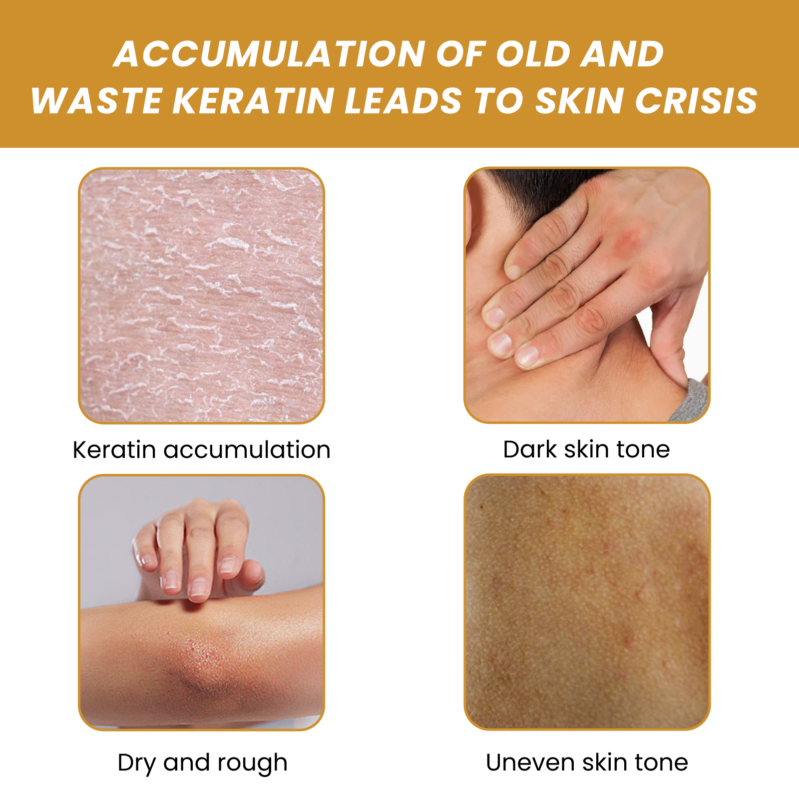 EELHOE Turmeric Body Scrub Lightens acne marks, moisturizes, smoothes and rejuvenates the skin, cleanses the body exfoliating scrub-CLEJOY