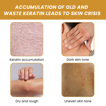 EELHOE Turmeric Body Scrub Lightens acne marks, moisturizes, smoothes and rejuvenates the skin, cleanses the body exfoliating scrub-CLEJOY