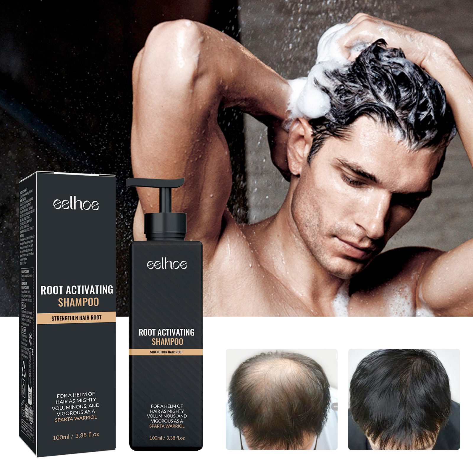 EELHOE hair growth shampoos