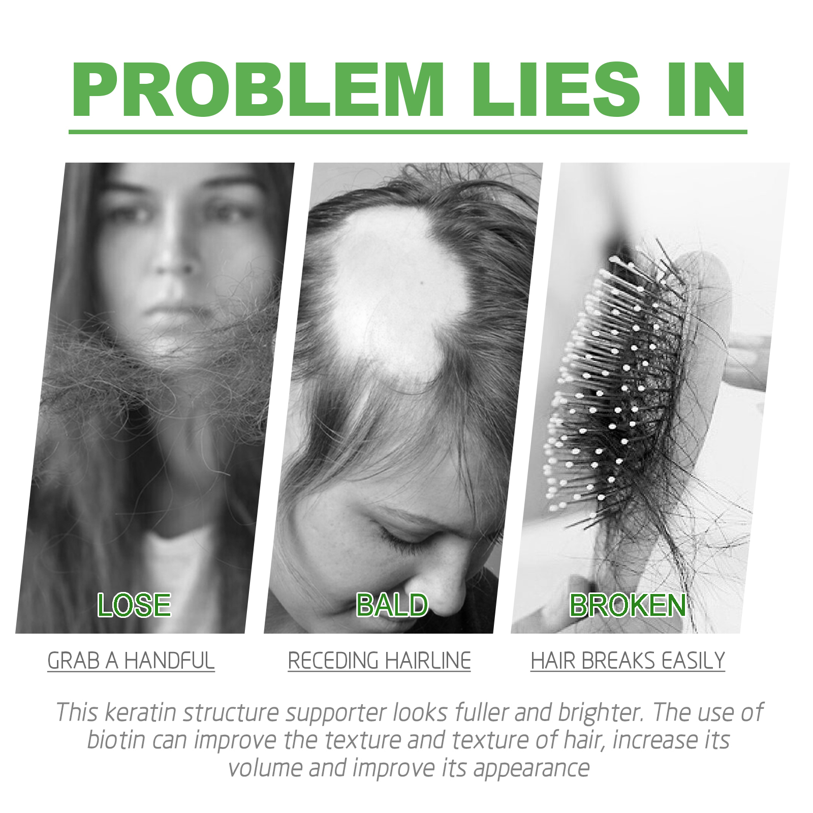 EELHOE Ginger Hair Thickening Capsules Hair Root Nourishing and Thickening Hair Strong and Anti-Loss Scalp Massage Care Capsules-CLEJOY