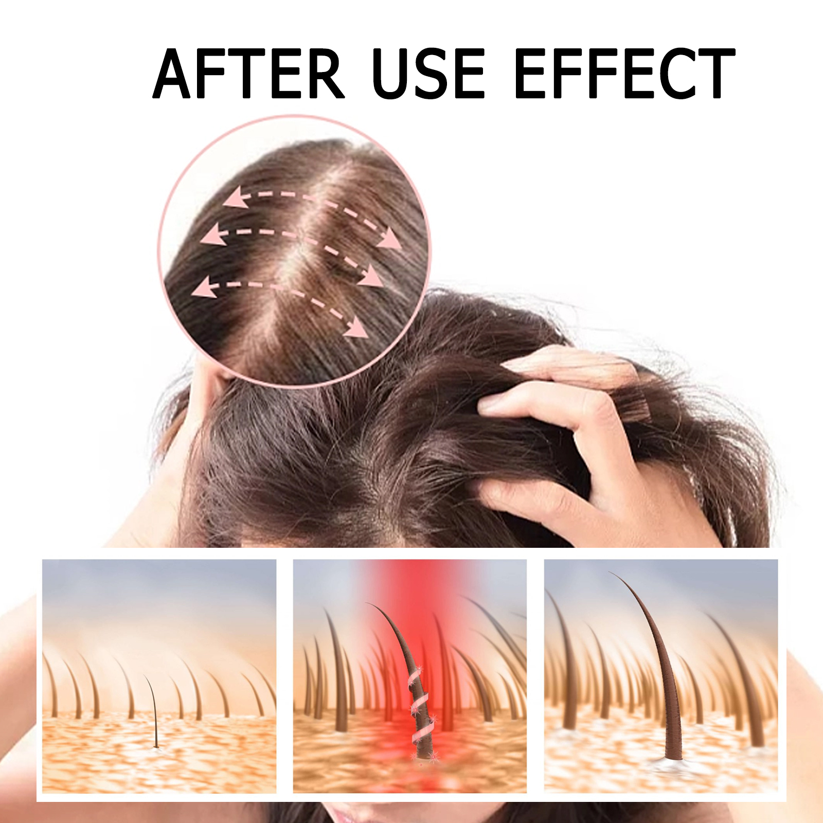 EELHOE Ginger Hair Thickening Capsules Hair Root Nourishing and Thickening Hair Strong and Anti-Loss Scalp Massage Care Capsules-CLEJOY