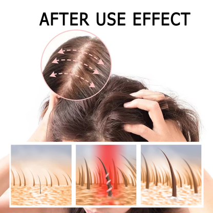 EELHOE Ginger Hair Thickening Capsules Hair Root Nourishing and Thickening Hair Strong and Anti-Loss Scalp Massage Care Capsules-CLEJOY