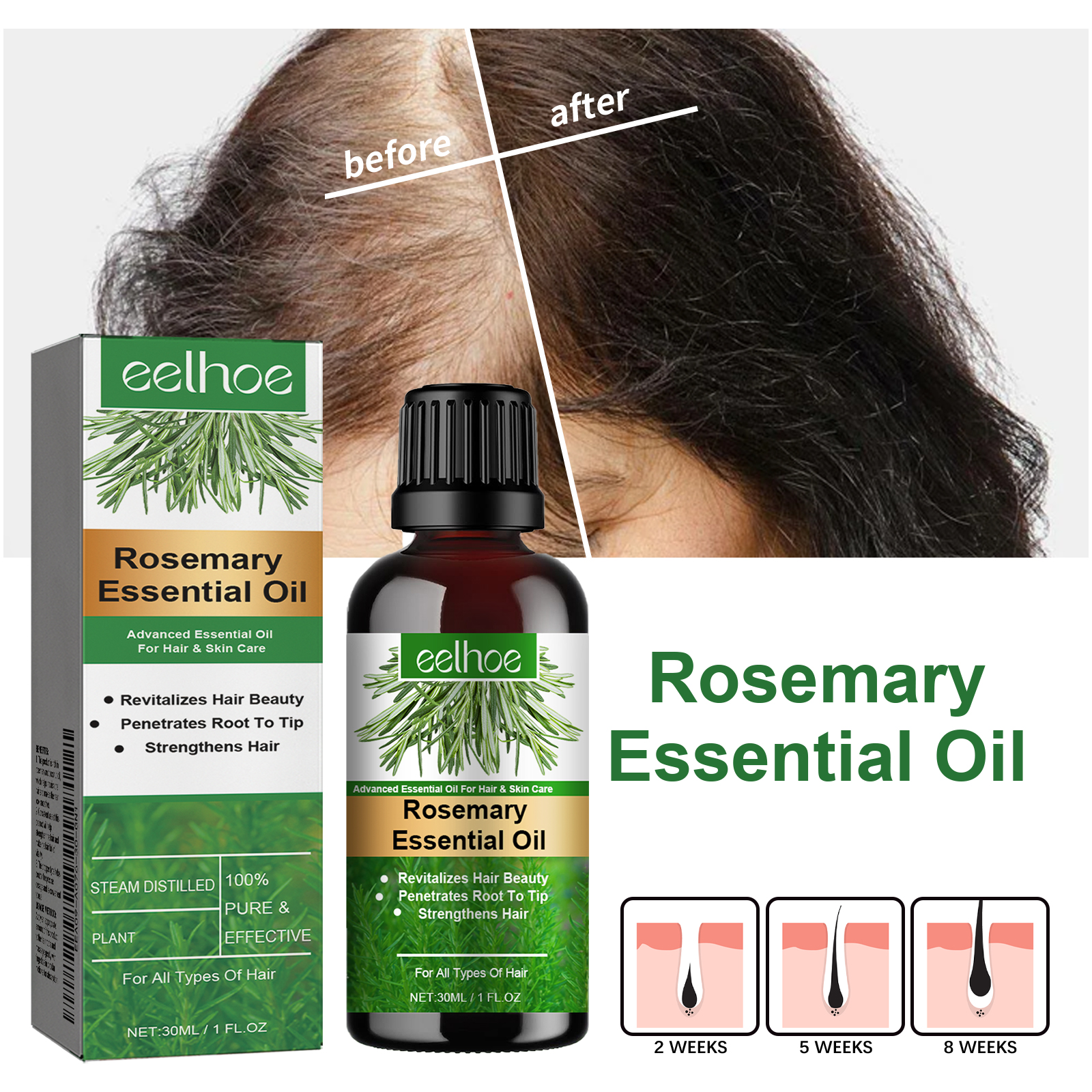 EELHOE Rosemary essential oil prevents hair loss, nourishes and softens hair, makes hair thick and scalp-care essential oil-CLEJOY
