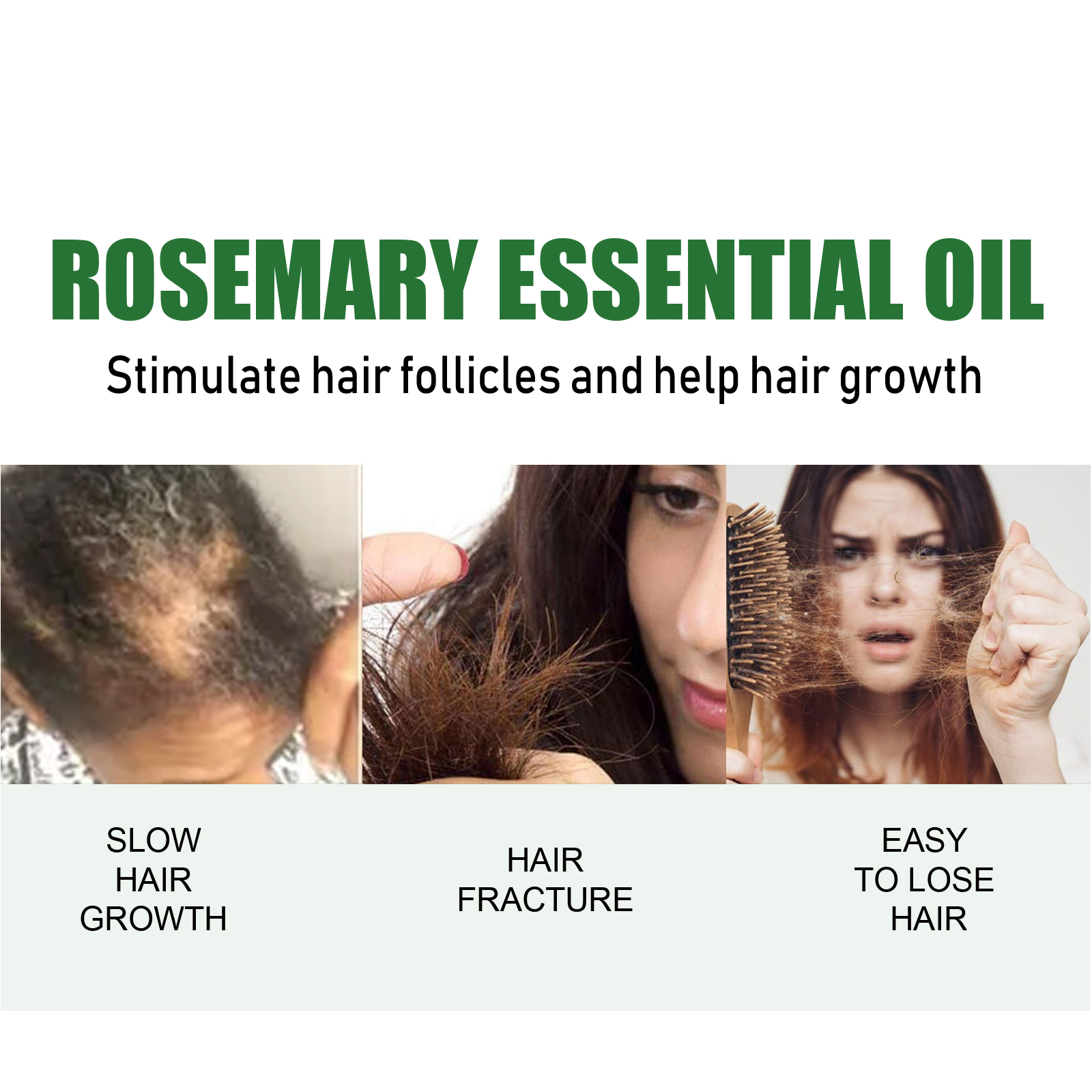 EELHOE Rosemary essential oil prevents hair loss, nourishes and softens hair, makes hair thick and scalp-care essential oil-CLEJOY