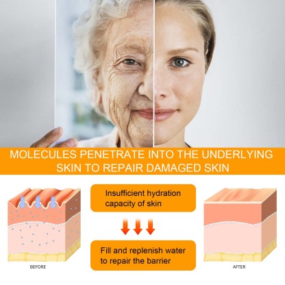 Hoygi 5D Peptide Anti-Wrinkle Eye Repair Cream Lightens fine lines and crow's feet, tightens and smoothes skin, and moisturizes the eye cream-CLEJOY