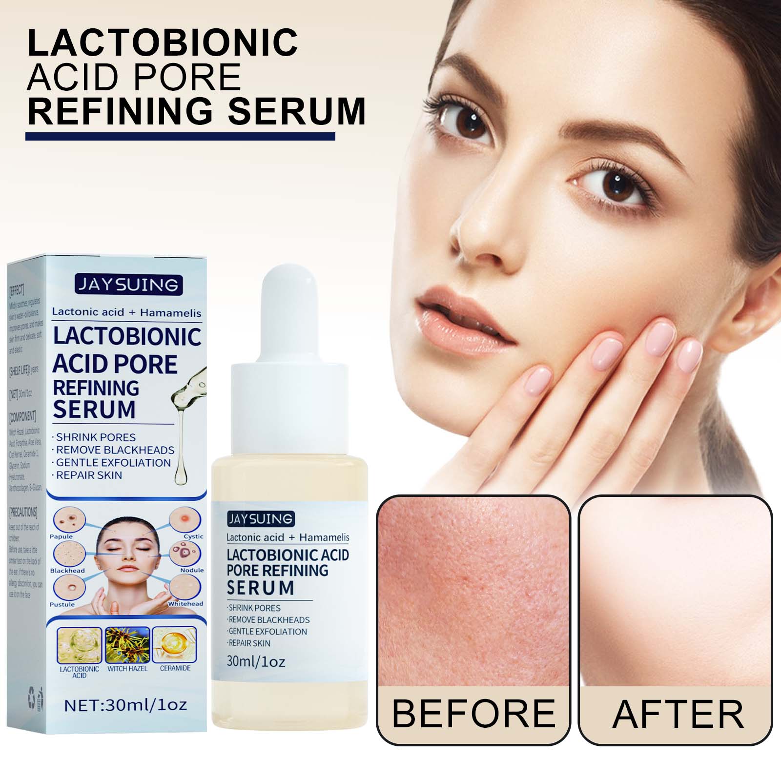 Jaysuing Lactobionic Acid Extract Exfoliates, Removes Blackheads, Tightens Pores, Cleanses, Moisturizes Skin-CLEJOY