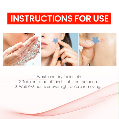 Jaysuing Star Color Acne Patches Repair acne scars, reduce acne spots, blemishes, and cover blackheads-CLEJOY
