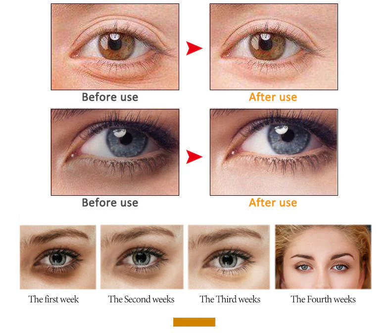 🌹Instant Firming Eye Cream Stick